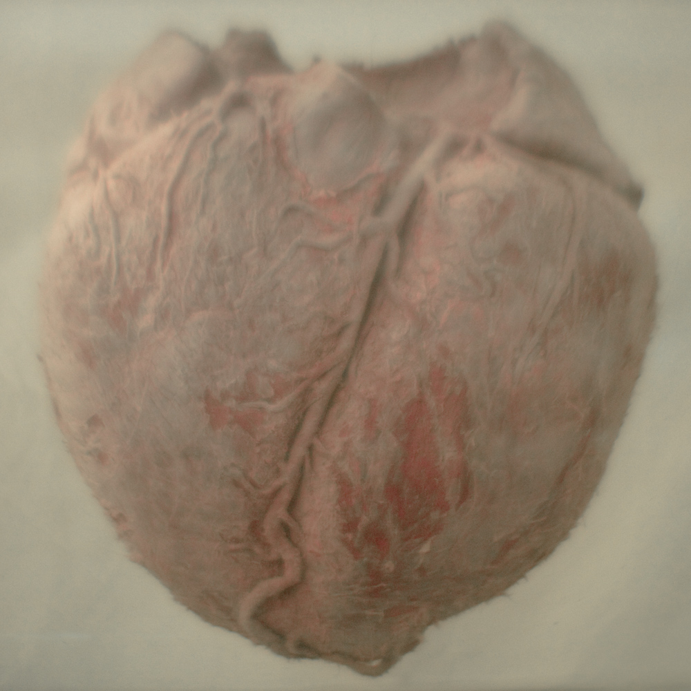 Balaenoptera bonaerensis: cor