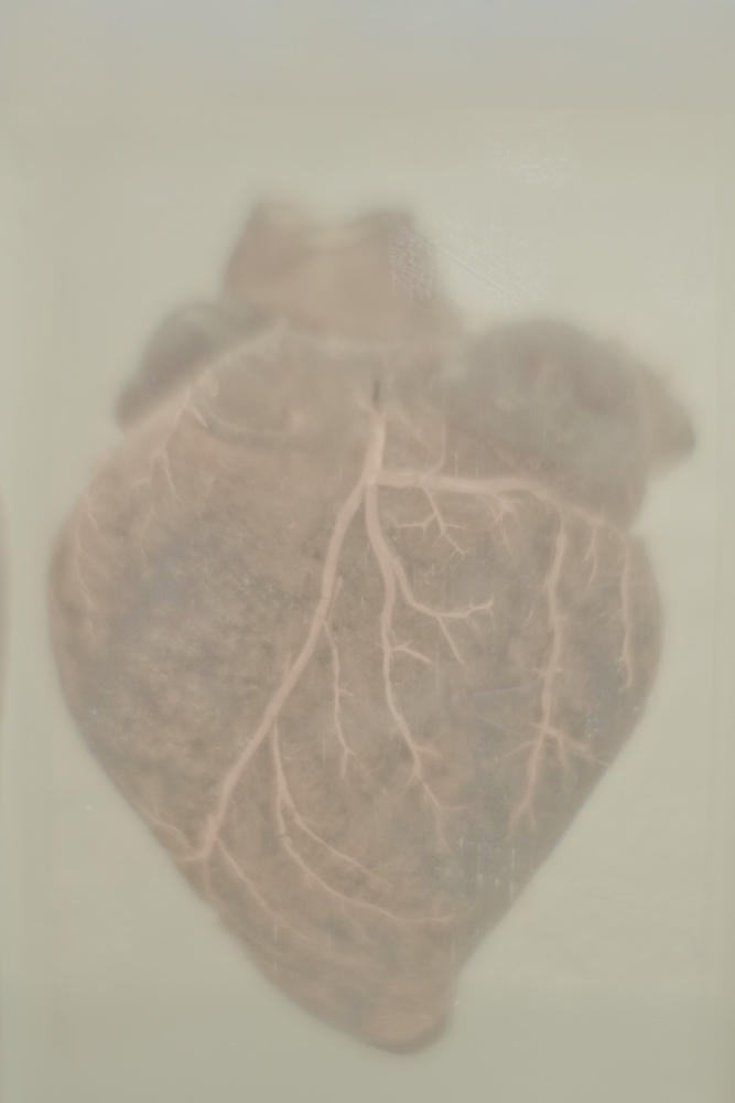 Chrysocyon brachyurus: cor